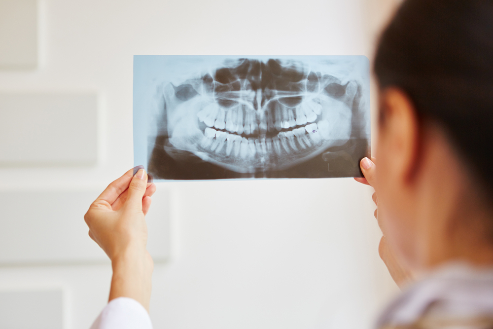 Do you need an annual dental X-ray?
