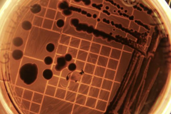 Bacteria are Fearsome, Especially When Weaponized